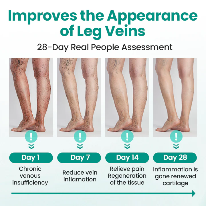 Healrize® LegRenew Varicose Veins Patch✨ - Image 4